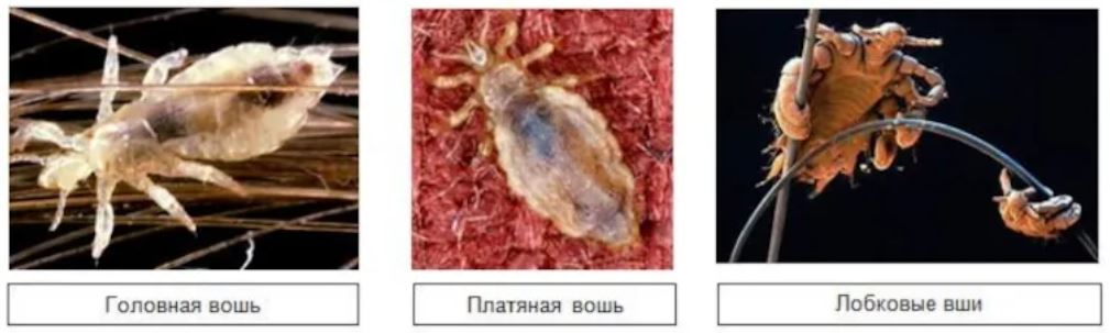 дезинфекция от вшей дезинфекция от вшей